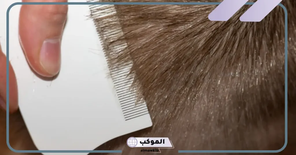 تفسير حلم القمل في الشعر وقتله للعزباء في المنام لابن سيرين.. هل له علاقة بالتقوى أم أنه حسد؟ 6 تفسير حلم نزع القمل من الشعر وقتله للمتزوجة