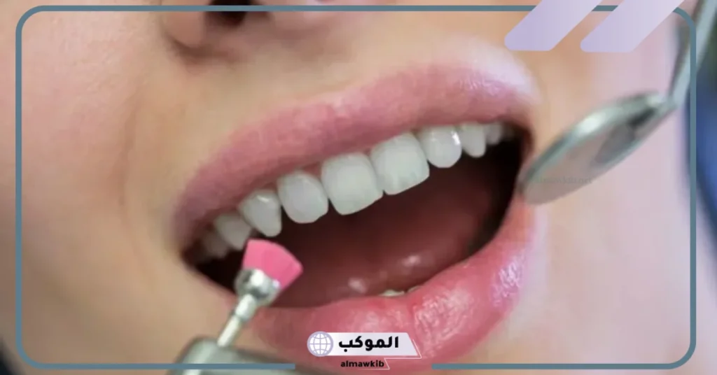 تجربتي مع جسر الاسنان عالم حواء