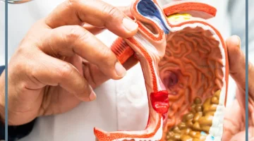 منظار المعدة