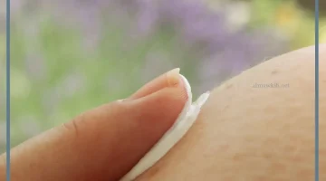 ميتاز للحساسية