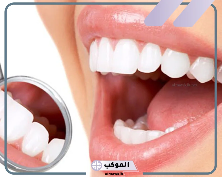 تجربتي مع عدسات الاسنان ومميزاتها وعيوبها