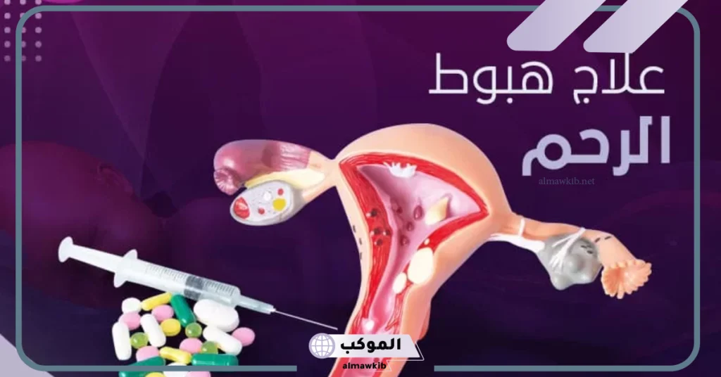 تجربتي مع نزول الرحم بالأسباب والأعراض 7 علاج نهائي لنزول الرحم للمرأة