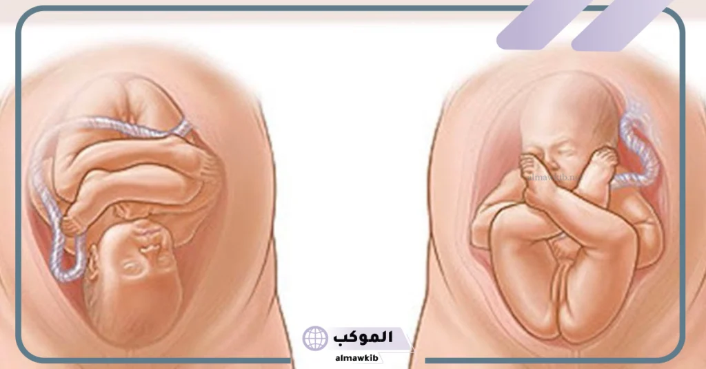 متى يأخذ الجنين وضعية الولادة؟  