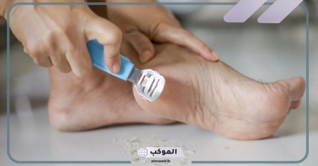 تفسير حلم رؤية إزالة الجلد الميت من القدم في المنام لابن سيرين 5 رؤية إزالة الجلد الميت من القدم في المنام للعزباء