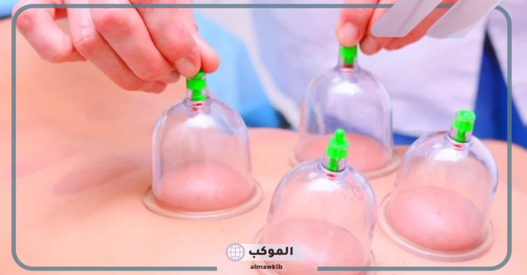 علامات نجاح الحجامة 