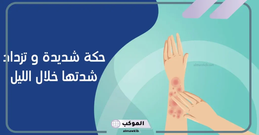أسباب حكة الجسم المفاجئة عند المرأة