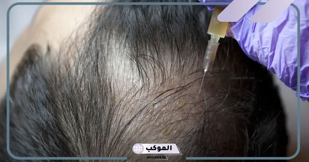 فوائد الخلايا الجذعية للشعر