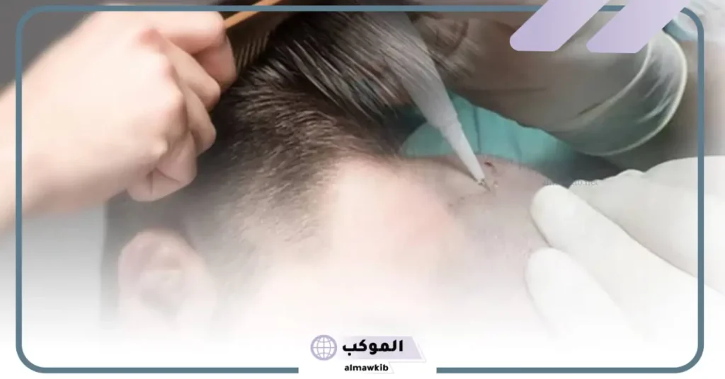 أضرار الخلايا الجذعية للشعر