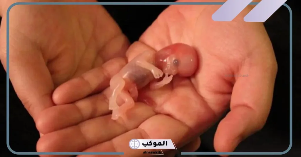 وصفات جدتى السحرية للإجهاض في المنزل بصورة طبيعية 5 زيت الخروع لإجهاض الجنين