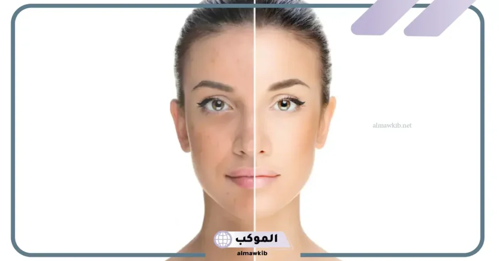 تجربتي مع شراب الكولاجين الالماني وفوائده ومدة الاستمرار عليه 6 فوائد شراب الكولاجين الألماني