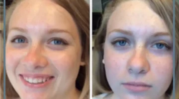 الهيدرا فيشل لتنظيف الوجه