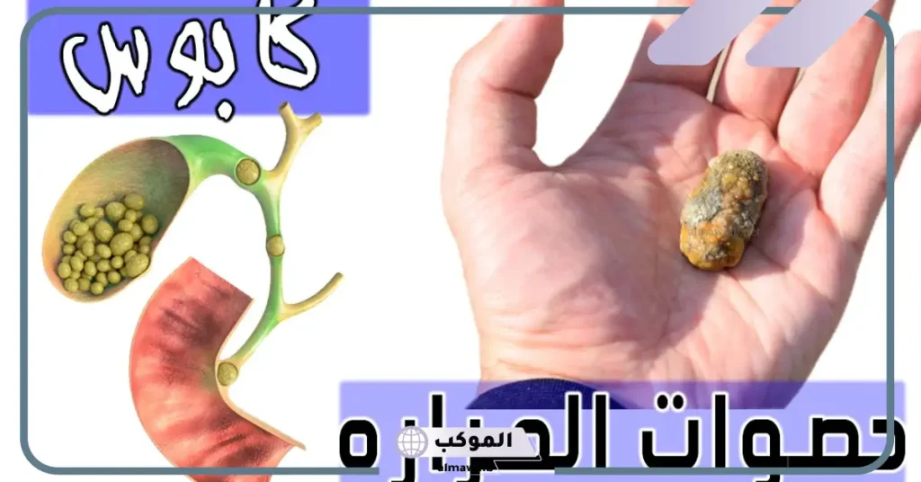كيفية التخلص من حصوات المرارة في يوم واحد بإذن الله من الطب البديل 6 هل يمكن التخلص من حصوات المرارة بدون ازالة المرارة؟