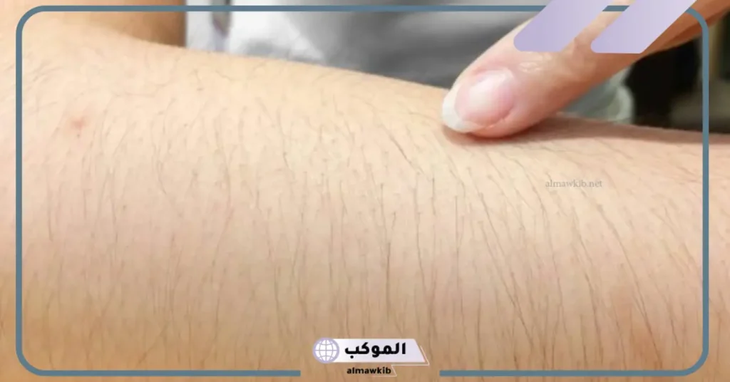 تفسير حلم رؤية شعر الذراع في المنام للمتزوجة والعزباء بالتفصيل لابن سيرين 5 تفسير رؤية شعر الذراع في المنام للعزباء