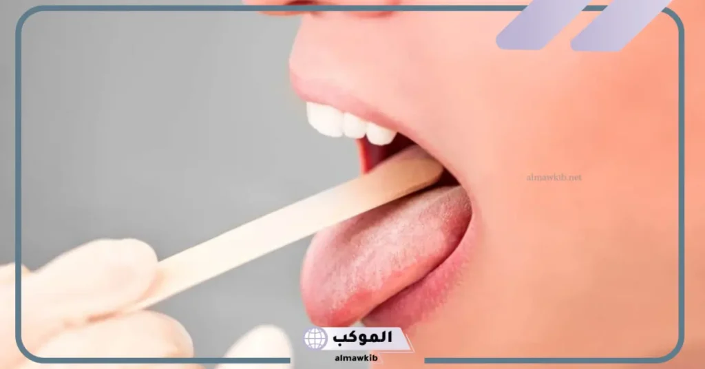 تفسير رؤية الفم في المنام لابن سيرين والنابلسي وخروج كتل بيضاء منه 6 تفسير رؤية الفم في المنام للمطلقة