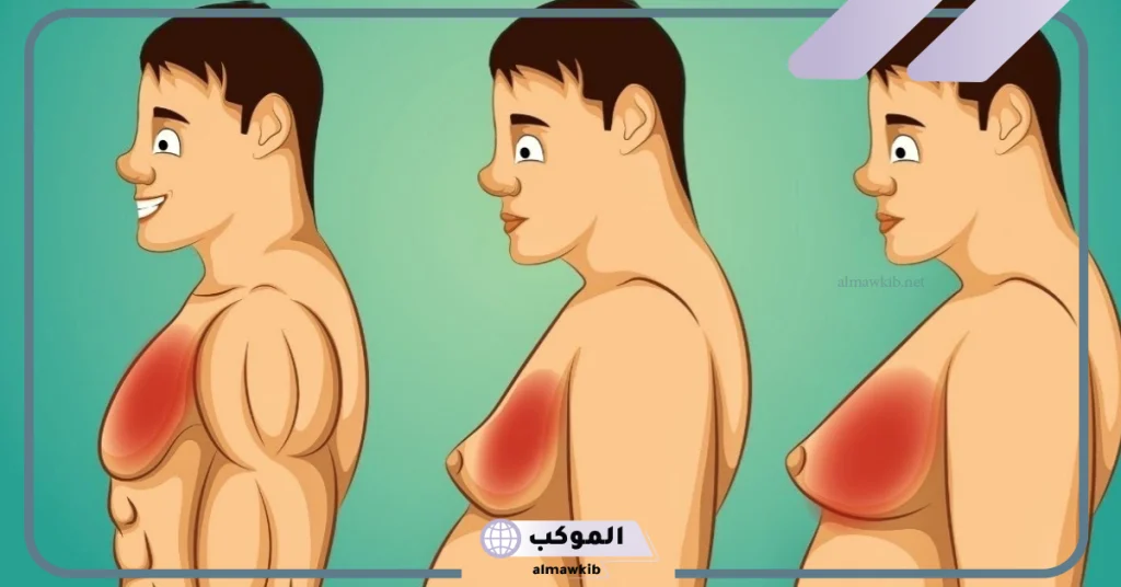 كيفية التخلص من التثدي عند الرجال في أسبوع.. أسباب التثدي 6 أسباب انتفاخ الثدي فجأة عند الرجل