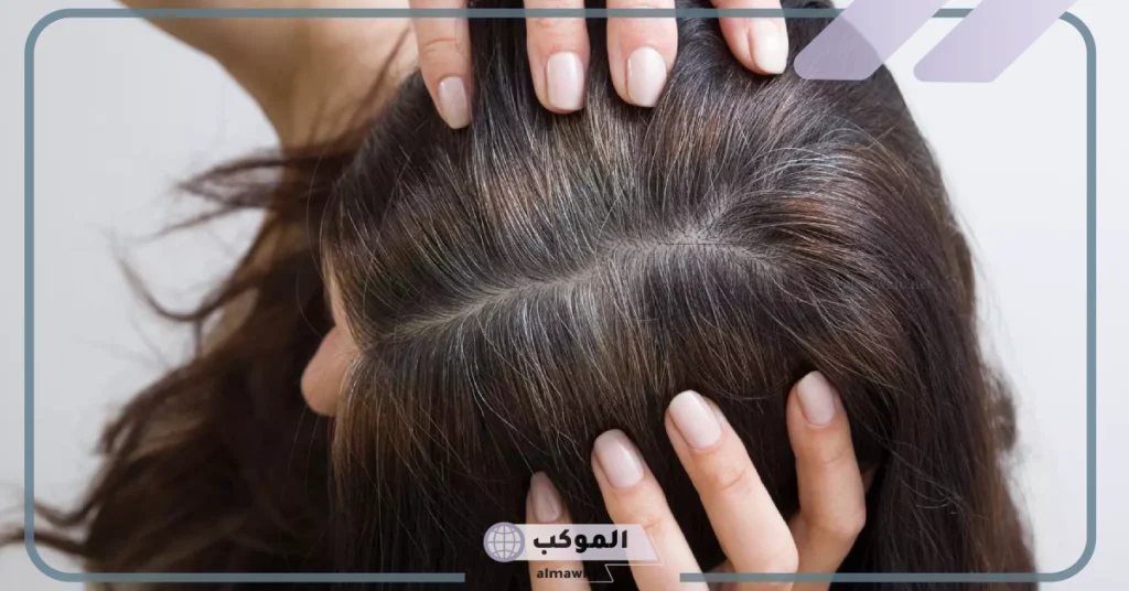 خلطة للشيب مجربة للقضاء نهائيًا على الشعر الأبيض 5 علاج الشيب نهائيًا مجرب