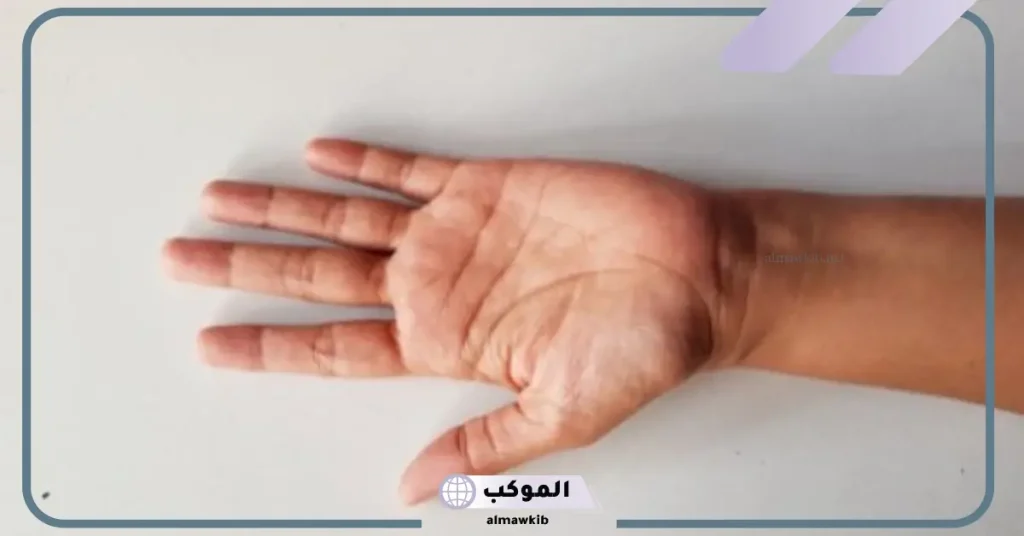 تفسير حلم قطع يد شخص بالسكين