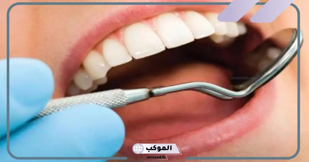 تفسير حلم تسوس الاسنان في المنام للعزباء والمتزوجة لابن سيرين 6 تفسير حلم تسوس الاسنان الأمامية للمتزوجة