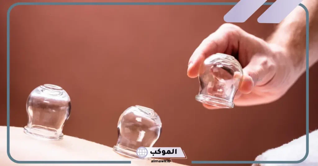 فوائد الحجامة للعين وعلاج الحسد من تجاربكم 5 تجاربكم مع الحجامة للعين والحسد والسحر