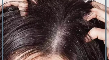 الصيبان في المنام