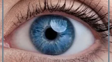 العين الزرقاء