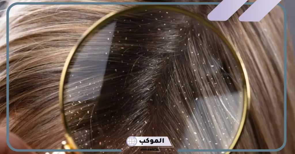 تفسير حلم الصيبان في الشعر وقتله للحامل 