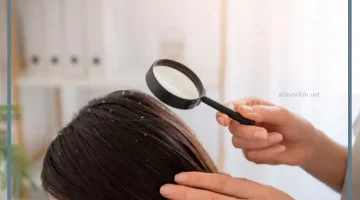 القمل في المنام