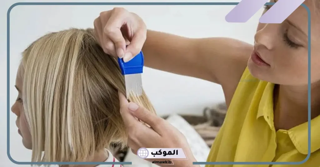 تفسير حلم القمل في الشعر للرجل 