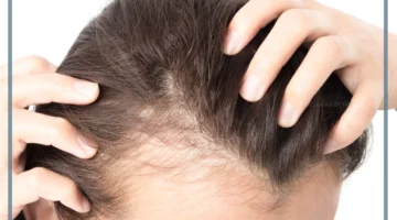 تفسير الثعلبة