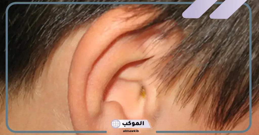 تفسير تنظيف الاذن في المنام للعزباء