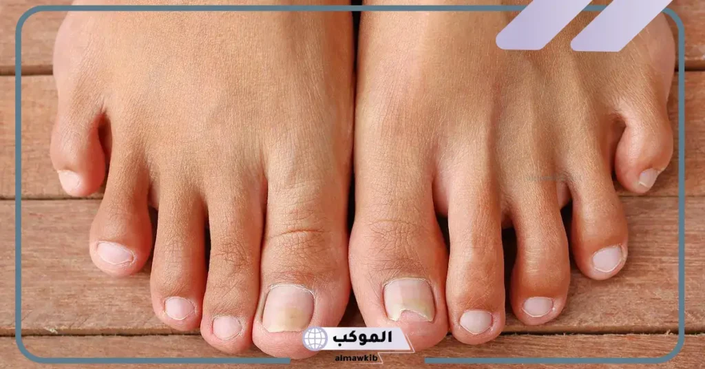 القدم في المنام للمتزوجة