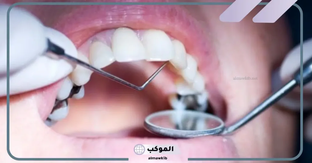 تفسير حلم تسوس الأسنان الأمامية العلوية للعزباء