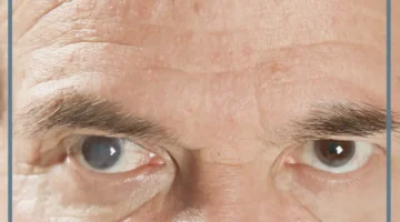 حلمت بفقدان عين