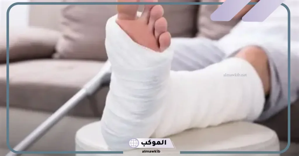 تفسير حلم كسر الرجل للعزباء