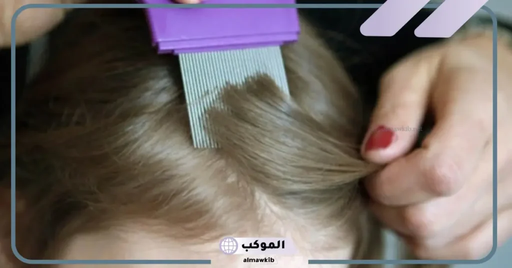 رؤية القمل في الشعر في المنام للعزباء