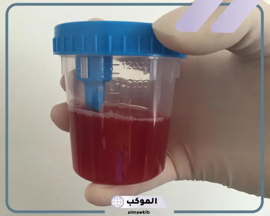 حلمت اني اتبول دم لابن سيرين والنابلسي