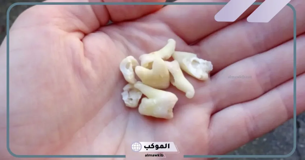 تفسير حلم تكسر الاسنان للمتزوجة