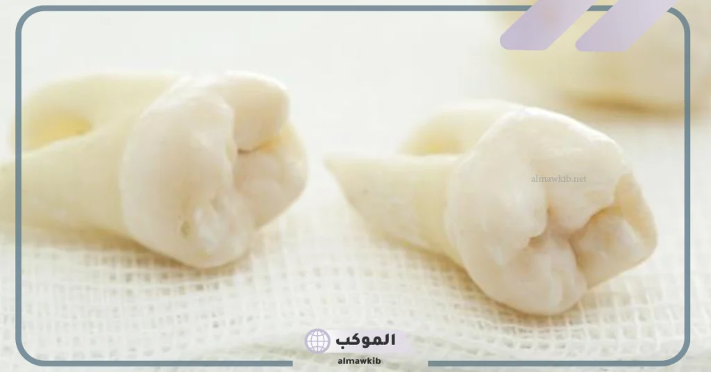 تفسير كسر الضرس العلوي 