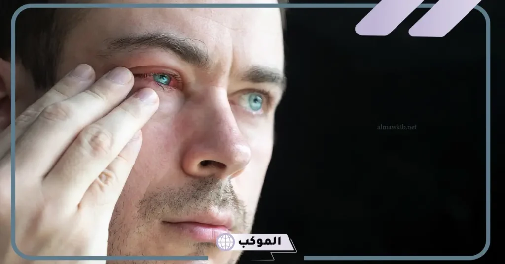 تفسير حلم فقدان عين واحدة في المنام وفقًا لابن سيرين 5 تفسير حلم فقدان عين واحدة للعزباء