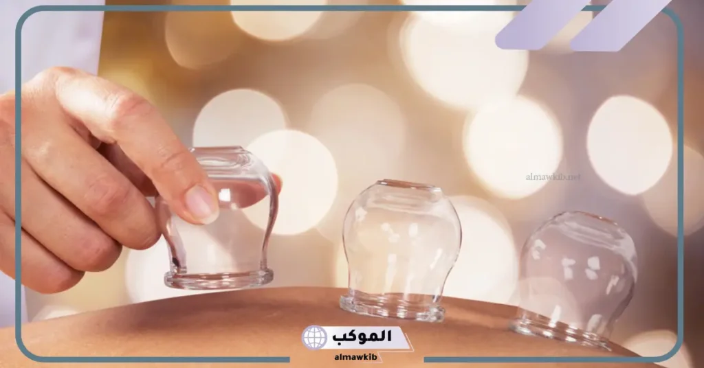 فوائد الحجامة للعين وعلاج الحسد من تجاربكم 6 هل الحجامة تبطل السحر والعين والحسد