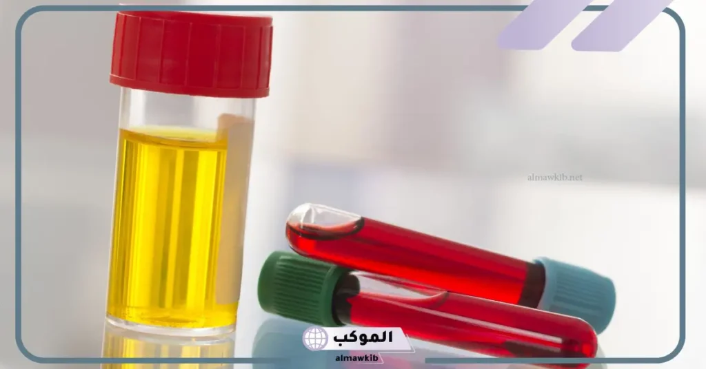 تفسير حلم البول وفيه دم في المنام للرجل والمرأة لابن سيرين والعصيمي 6 رؤية تبول الدم في المنام للمتزوجة