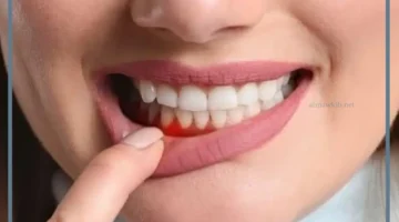 حلم خروج الدم