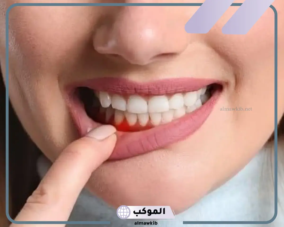 تفسير حلم خروج الدم من فم شخص اخر