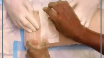 حلمت بقطع الرجل