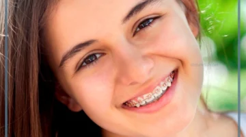 دلالات الابتسامة