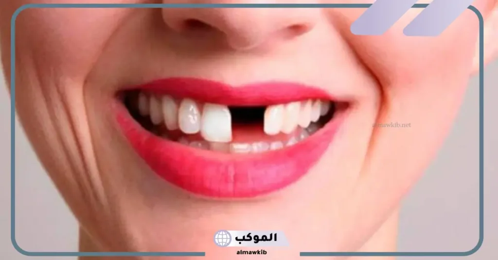 تفسير حلم سقوط الاسنان بدون دم في المنام لابن سيرين 5 تفسير حلم سقوط الاسنان بدون دم للعزباء