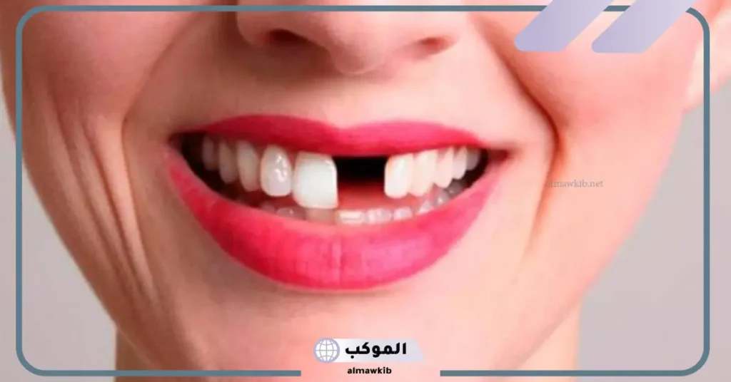 تفسير حلم سن مكسور للمتزوجة