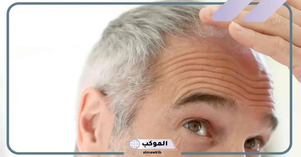 شيب الشعر في المنام للمتزوجة