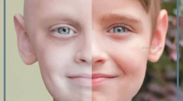 السرطان في المنام