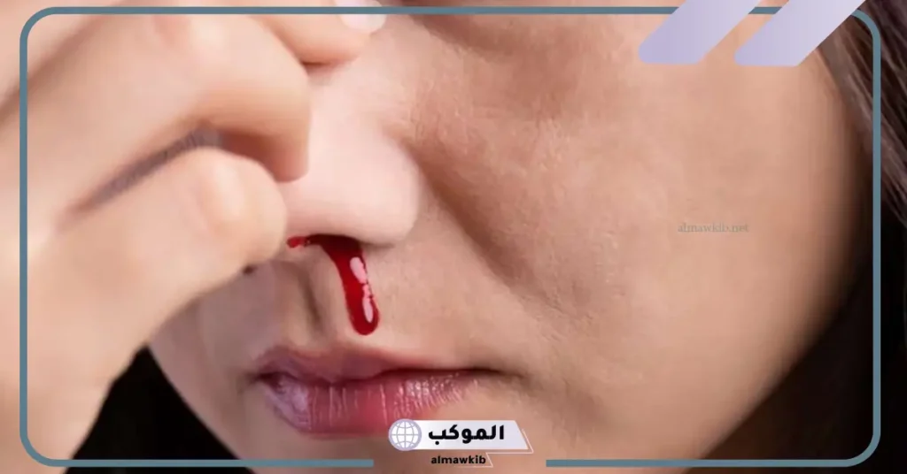 تفسير حلم خروج الدم من الأنف في المنام والنزيف لابن سيرين 5 رؤية خروج الدم من الأنف في المنام للعزباء